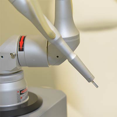 Fałdy okołoodbytnicze laserem